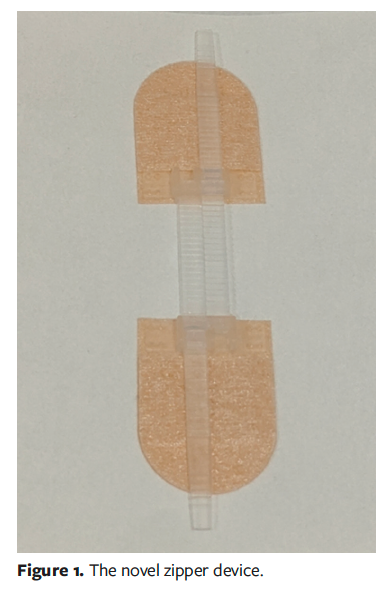 Use of a Novel Zipper Device for Wound Closure of Cutaneous